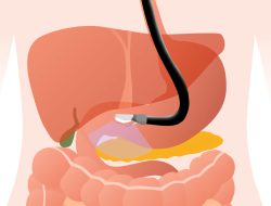 Fasilitas Kesehatan Bintang 5 Untuk Gastroenterologi Dan Endoskopi