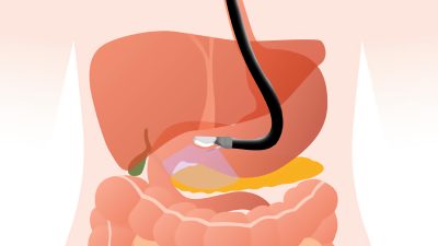 Fasilitas Kesehatan Bintang 5 untuk Gastroenterologi dan Endoskopi