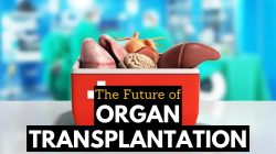 Exclusive Healthcare Packages For Organ Transplantation And Surgery